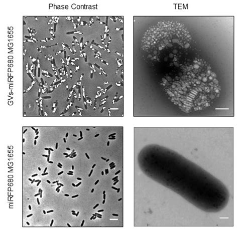 Phase Contrast Microscopy Bacteria