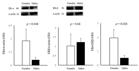 Influence Of Sex On The Expression Of Erα And Erβ Proteins In Female