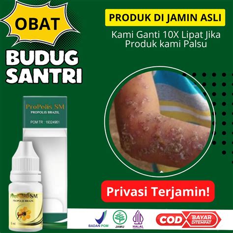 Jual Propolis SM Salep Budug Santri Salep Budugan Di Kaki Dan Tangan