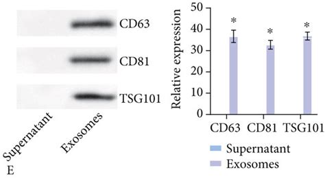 Msc Derived Exosomal Lncrna Igf As Might Promote Pyroptosis Of Epcs In