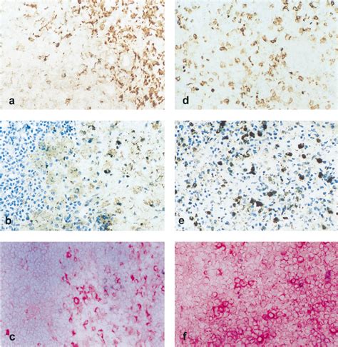 Tnf Producing Cells In Lymphoid Organs From Asfv Infected Pigs