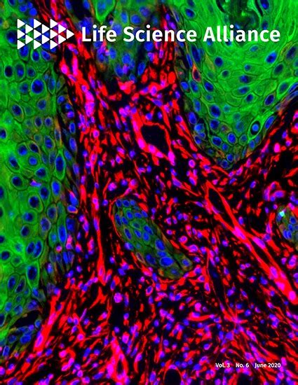 Microtubule Dependent And Independent Roles Of Spastin In Lipid Droplet