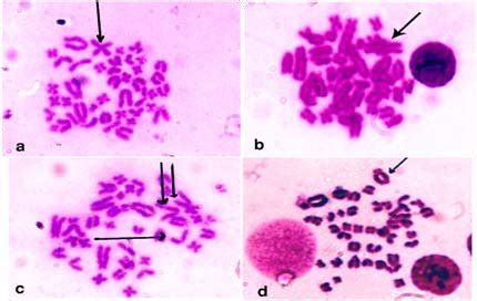 Metaphase Stage Of Rat Bone Marrow Cells Showing Normal Chromosomes Of