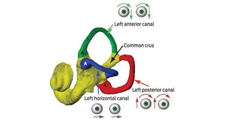 Horizontal Canal Repositioning Maneuver