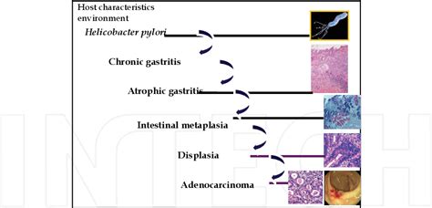 Figure From Virulence Factors Of Helicobacter Pylori And Their