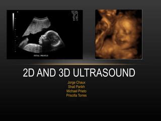 D And D Ultrasound Ppt