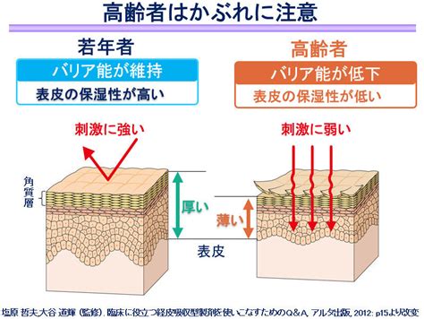 温湿布と冷湿布の効果は同じ いまさら聞けない「貼り薬」のあれこれ マイナビニュース