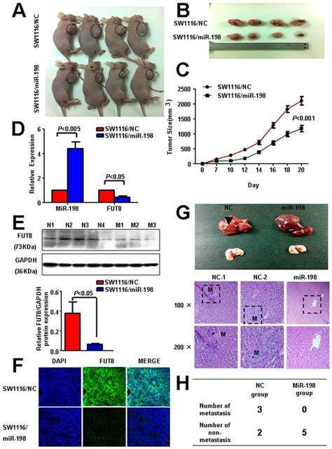 Mir 198 Suppresses Fut8 Expression And Inhibits Tumor Growth And