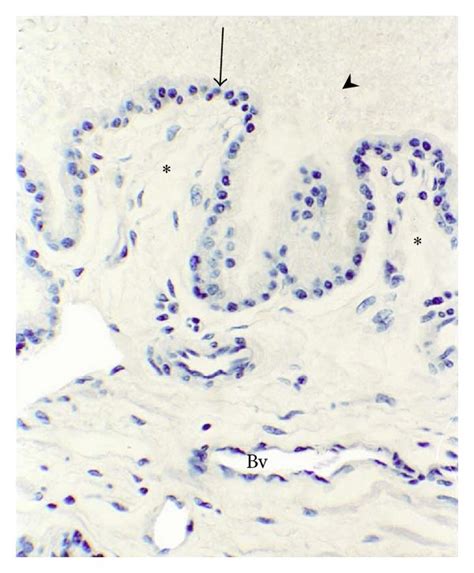 Photomicrographs Of The Prostate After Alcian Blue Staining During