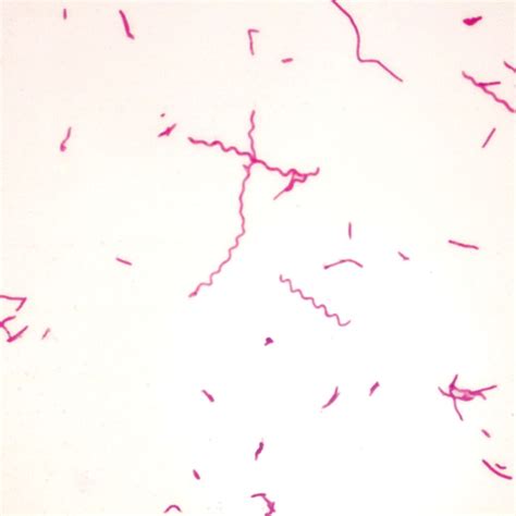 Typical Bacteria Microscope Slide – SMARTQAT