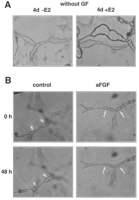 A Juner Induced Disruption Of Tubular Morphogenesis Is Inhibited By