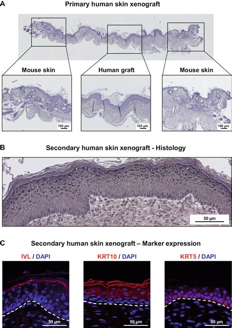 A Tissue Sections Hematoxylin Eosin Saffron Hes Staining Of