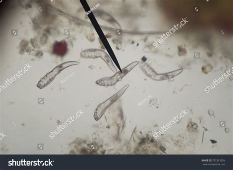 10,318 Microscope parasite Images, Stock Photos & Vectors | Shutterstock