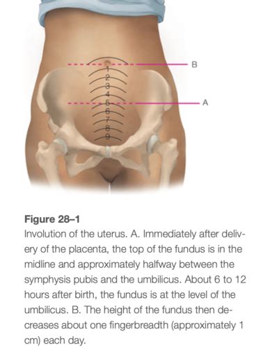 Unit 2 Postpartum Flashcards Quizlet