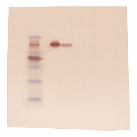 Western Blot Test For Hiv Qaswp