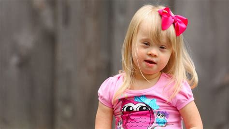 Girl With Down Syndrome Changing Face Of Modeling