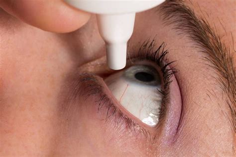 How To Tell If You Need Cataract Surgery Bullide