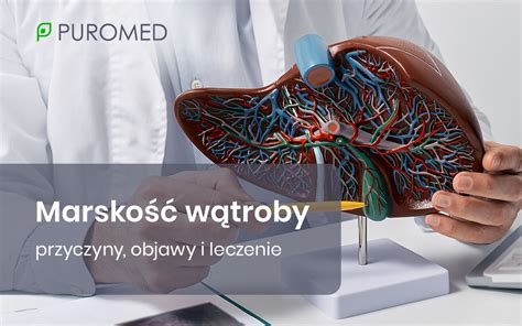 Marskość wątroby przyczyny objawy i leczenie PUROMED