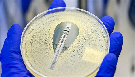 Understanding Mrsa Reproduction Homeostasis Lab