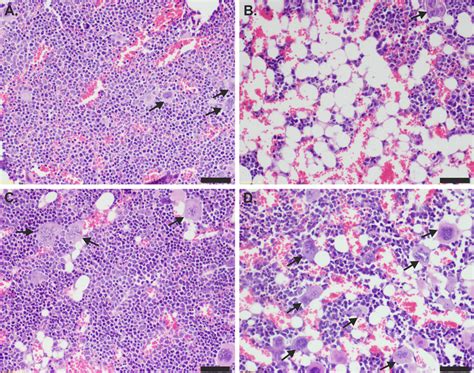 Histology of bone marrow sternum of A age matched naïve mice