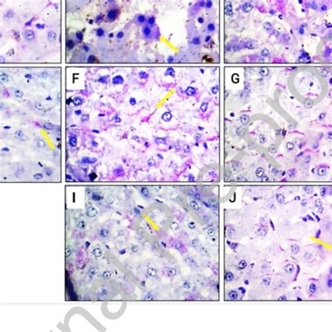 Representative Light Photomicrographs Of Liver Sections Demonstrated By