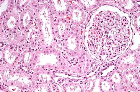 Macula Densa Histology