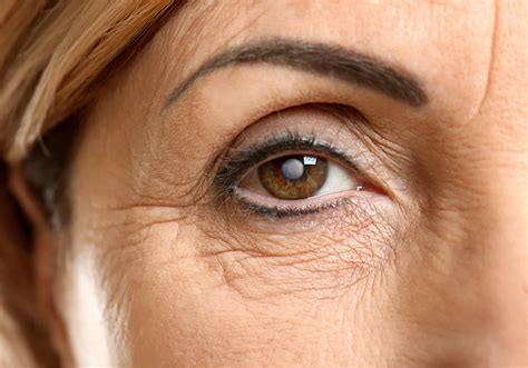 How Long Does Cataract Surgery Take Laser Eye Center Of Miami