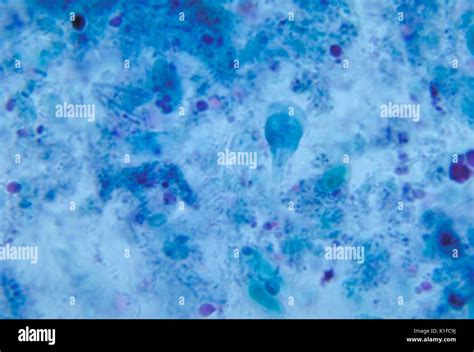 Giardia Lamblia Trophozoite Trichrome Stain Parasite Image Courtesy