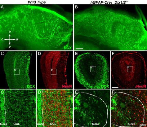 Tangential And Radial Migration Defects Of Dcx Cells In The Adult Svz