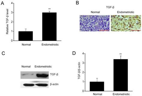 Overexpression Of Tgf‑β Enhances The Migration And Invasive Ability Of