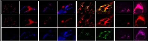 biogenesis-exosomes | Exosome RNA