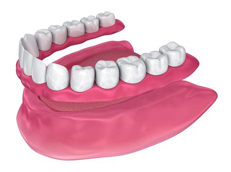 Soft Liners Piedmont Dental Associates