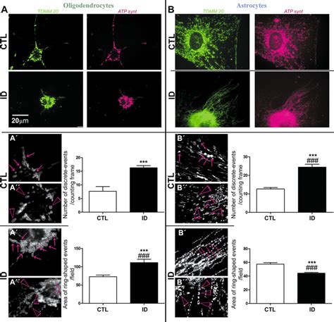 Mitochondrial Morphometry Icc Images Of Tomm And Atpsyn Depicted