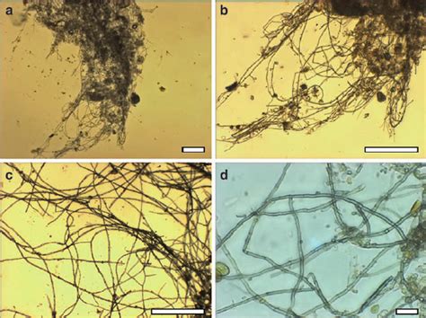 Fungal Biofilm