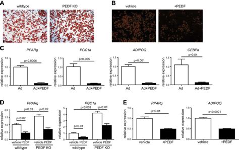 Pedf Suppresses Adipogenesis A Mscs Derived From Svcs From The