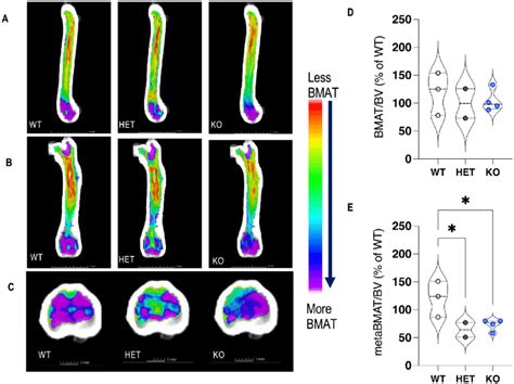 Bone Marrow Adipose Tissue Bmat Quantification Via High Resolution Download Scientific