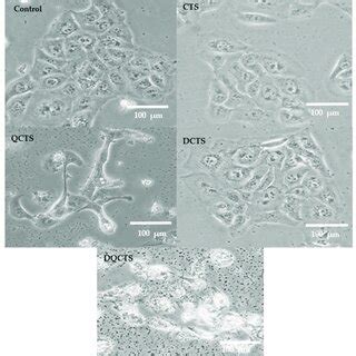 Cell Viability Of HaCaT Cells Treated With Chitosan Compounds At 50