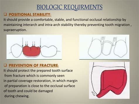 Provisional Restoration Ppt