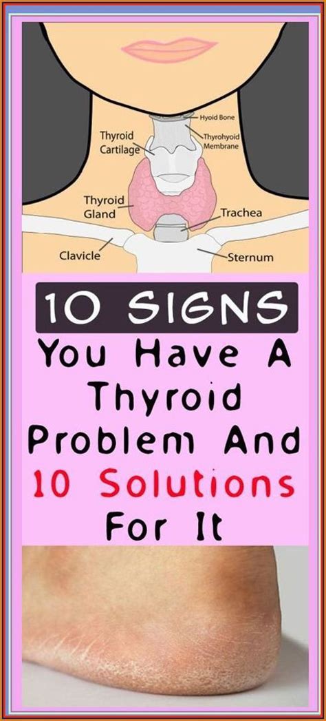 10 Signs You May Have A Thyroid Problem Read How To Find Out About It And How To Fix It Artofit