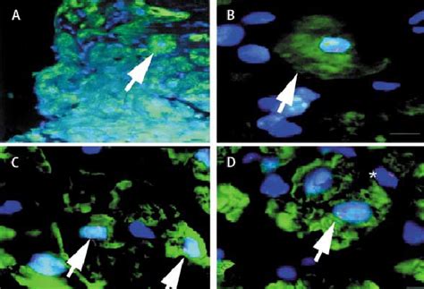 Immunostaining And In Situ Hybridisation For Y And X Chromosomes In