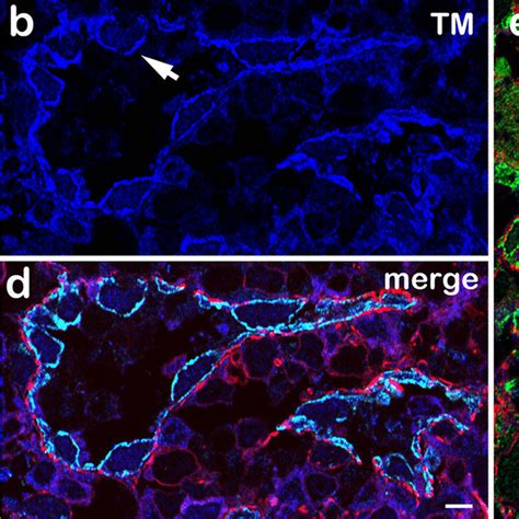 Laser Scanning Microscopy Of Triple Immunostaining For Mif Tm And