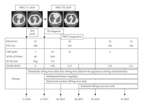 Clinical Case Summary Hrct High Resolution Computer Tomography Ild Download Scientific