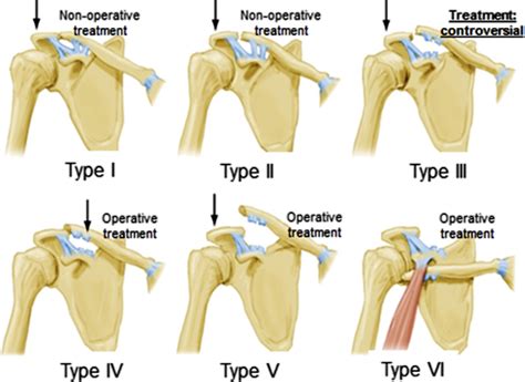 Current Sports Medicine Reports