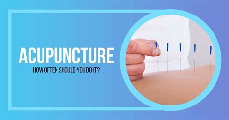 Acupuncture How Often Should You Do It