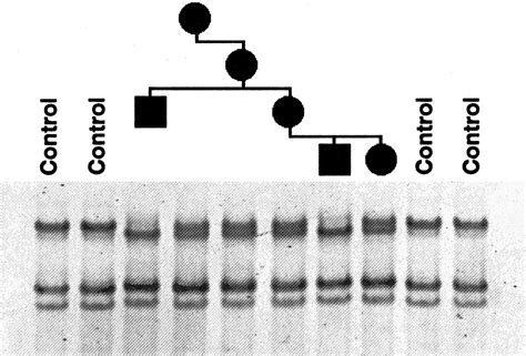 Genomic Organization Of The Human Pex Gene Mutated In X Linked Dominant