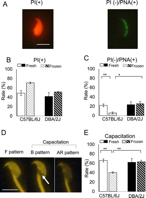 Plasma Membrane Integrity Acrosomal Status And Capacitation Status Of