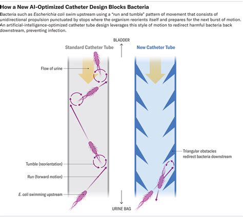Indwelling Urinary Catheter Diagram Indwelling Urinary