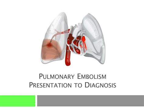 Ppt Pulmonary Embolism Presentation To Diagnosis Powerpoint Presentation Id 3010933