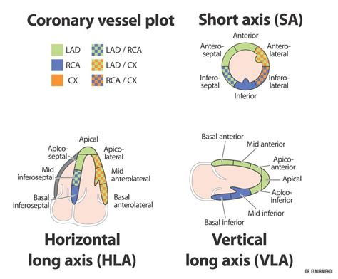 Left Ventricular Myocardial Segmentation And Coronary Artery Territories