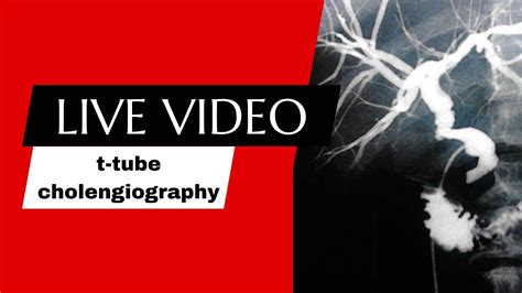 t-tube cholangiography procedure @radiologytechnologistamir ...